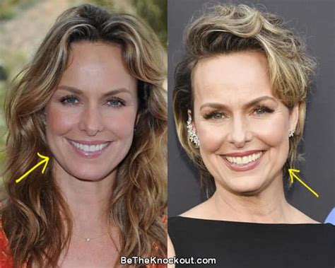 Melora Hardin Plastic Surgery Comparison Photos .